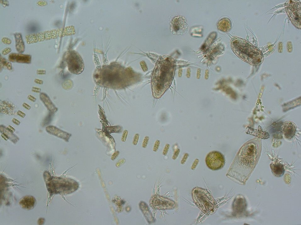 Plankton onder de microscoop
