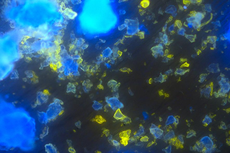 Microplastics fluorescentiemicroscoop